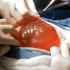 Biliary Cystadenoma in a 10-Month-Old Kitten and Its Successful Surgical Removal.