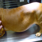Cushing's Disease