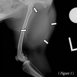 Fig. 1: Intermuscular Lipoma