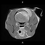 Katie: Axial T1-+C